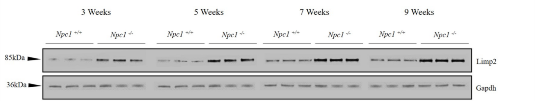 A western blot is shown depicting differential proteomics during disease progression of NPC
