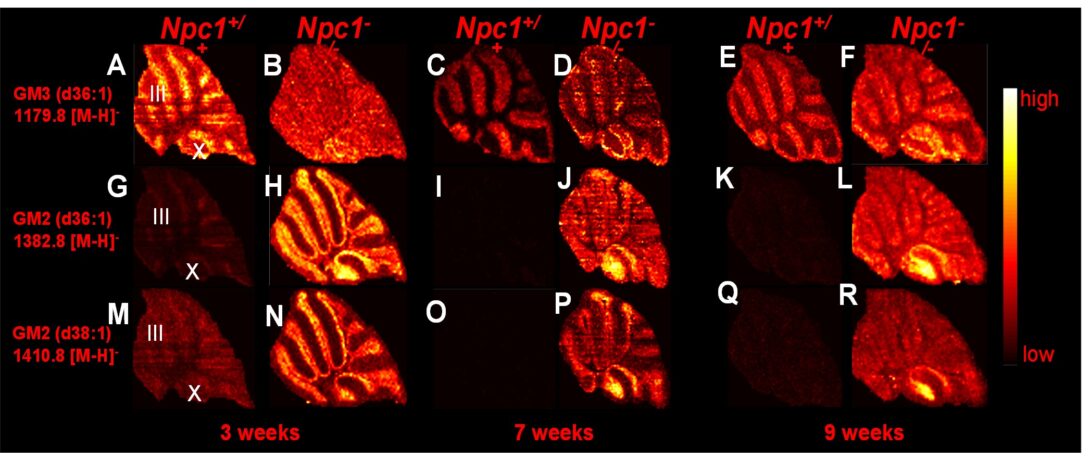 MALDI images of mouse brain tissue